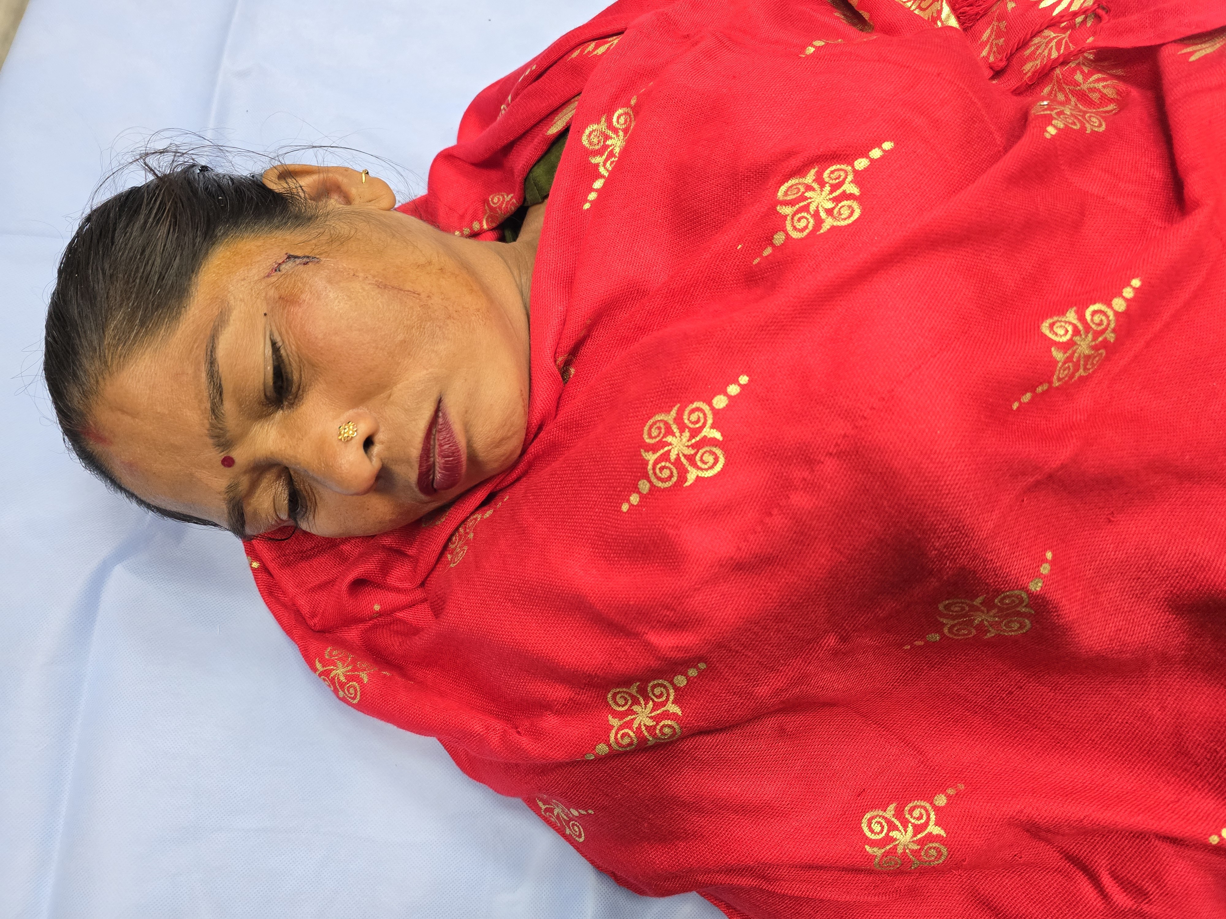 महिला के सिर में लगी चोट।