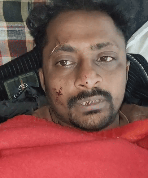 घायल विक्रम हीराजी ठाकुर ने बताया कि अचानक पीछे से आई कार ने हमारी गाड़ी को टक्कर मार दी। इसके बाद क्या हुआ मुझे नहीं पता।