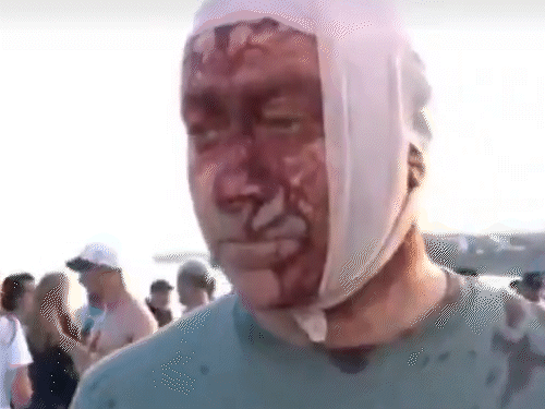 આતંકવાદી હુમલામાં ઇઝરાયેલ-ઓસ્ટ્રેલિયા યહૂદી પરિષદના અધ્યક્ષ આર્સેન ઓસ્ટ્રોવ્સ્કી પણ ઘાયલ થયા હતા. ઓસ્ટ્રોવ્સ્કીને માથામાં ઈજા થઈ હતી.