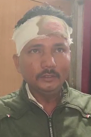 ठेकेदार पिंटू शर्मा ने भास्कर रिपोर्टर को बताया- हमलावरों ने गोली मारने की धमकी दी।