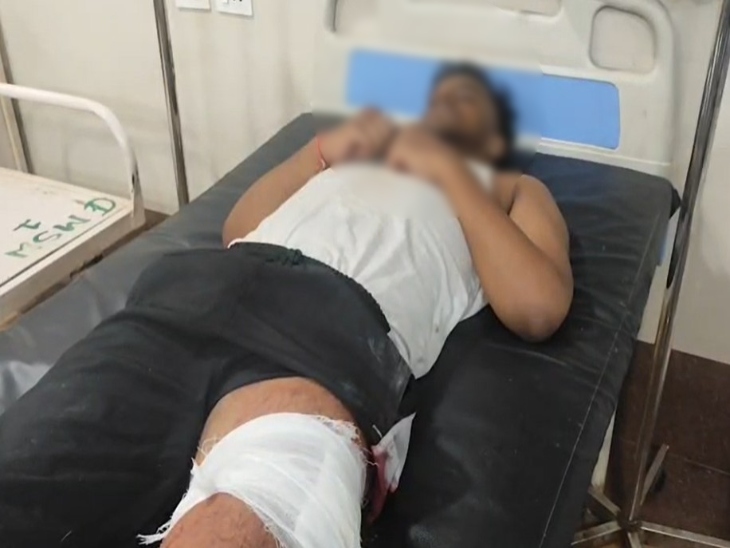 घायल छात्र अस्पताल में एडमिट है।