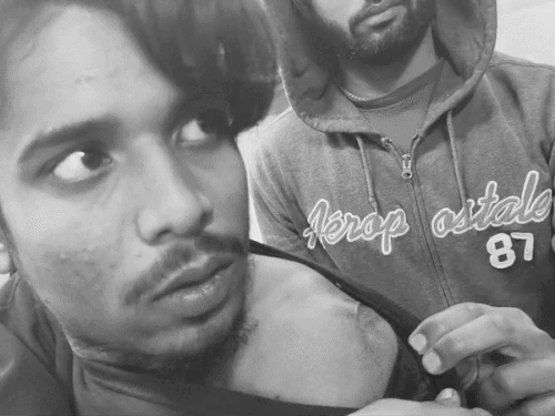 लुधियाना में युवक से लूट छीना मोबाइल:  विरोध करने पर चाकू से किया हमला 15 टांके लगे – Ludhiana News