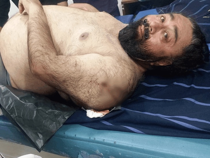 अस्पताल में भर्ती पूर्व पार्षद नरिंदरपाल सिंह सिद्धू। उनके कंधे पर गोली लगी है। - Dainik Bhaskar