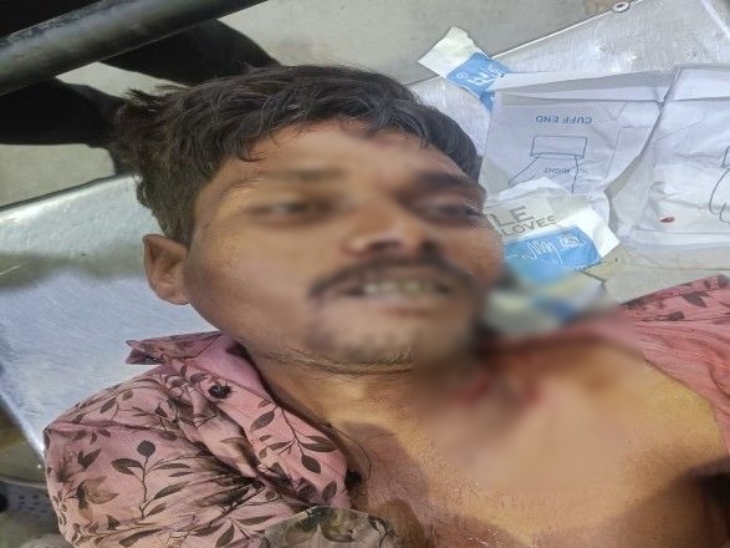 चाकू से हमला और रॉड से मारपीट में युवक ने दम तोड़ दिया।