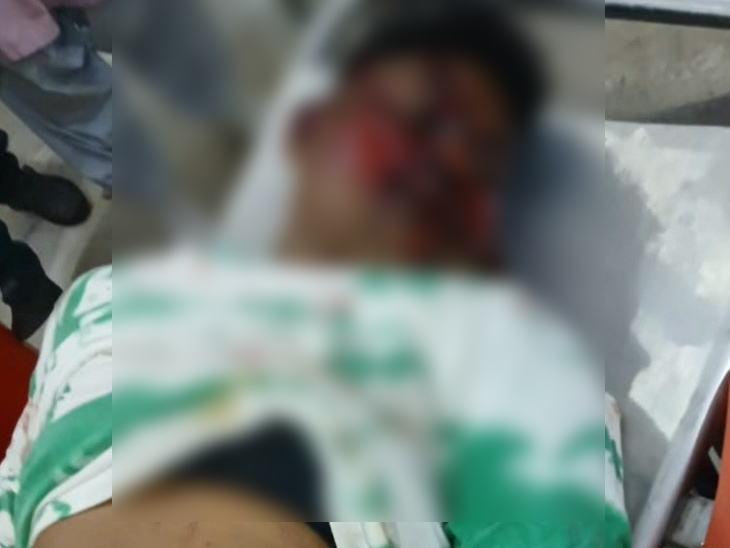 पुलिस ने शव को पोस्टमॉर्टम के लिए भिजवा दिया है।