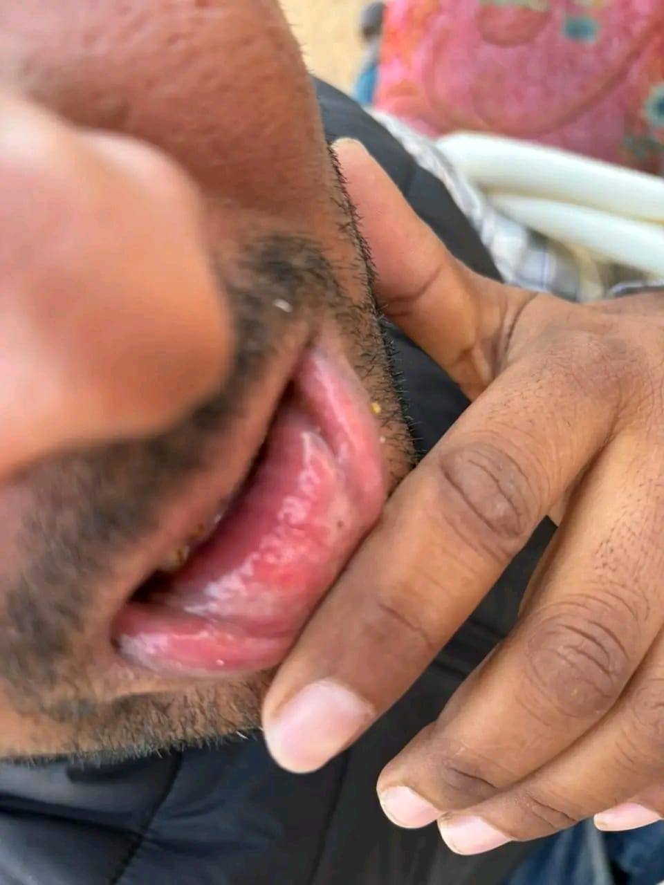 ब्लेड से कटे होंठ को दिखाता युवक।