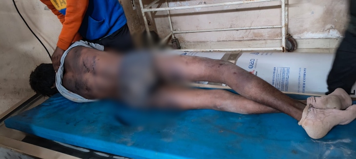 पुरानी रंजिश में युवक का अपहरण, पीट-पीट कर मार डाला:  थाने में परिजनों की पुलिस ने नहीं लिखी रिपोर्ट, बोले-कार्रवाई होती तो बच जाती जान – Mungeli News