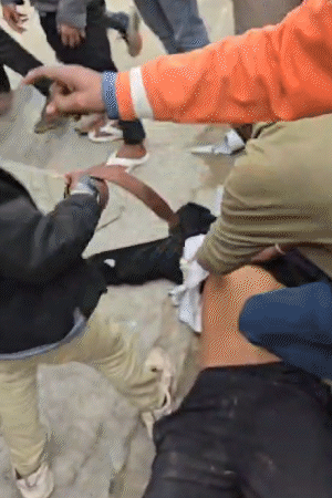 वारदात के बाद कॉलेज में अफरा-तफरी मच गई। साथी छात्रों ने जख्म को कपड़े से बांधा।