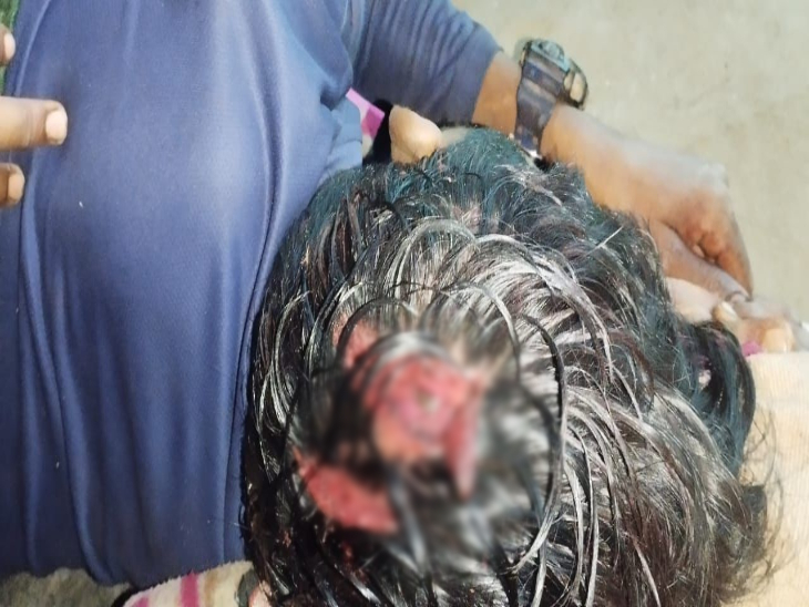 नक्सलियों ने बुदरा के सिर पर धारदार हथियार से हमला किया।