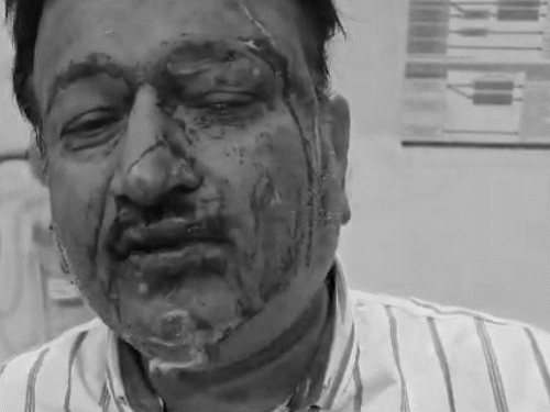 अंबिकापुर में डंडे से हमले में व्यापारी का सिर फूट गया।