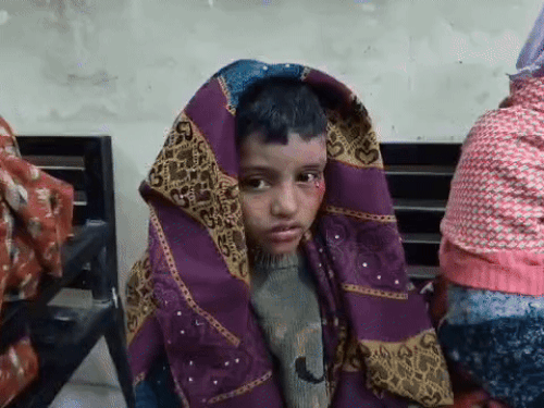 मासूम बच्चे की आंख के पास लगी चोट