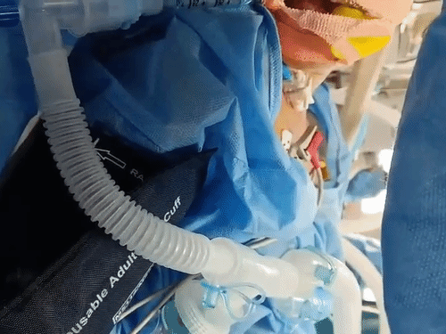 छात्र को 5 दिन से होश नहीं आया है। आईसीयू में उसका उपचार चल रहा है।