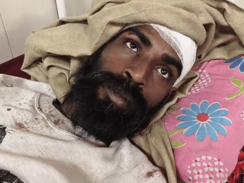 पीड़ित अजय कुमार जानकारी देते हुए