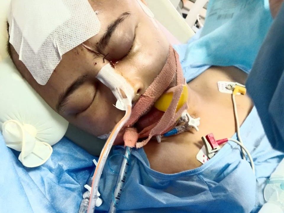 मानसी को गंभीर चोट आई है। उसका चेहरा सूज गया है। आंखें नहीं खुल रही हैं।