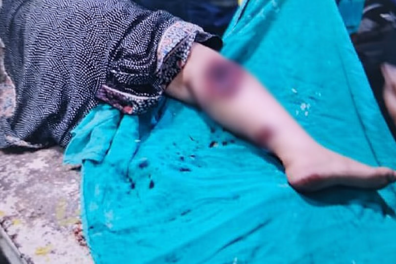 ग्वालियर में जमीन विवाद में गोली चली:  10 बीघा जमीन को लेकर पति पर देवर ने चलाई गोली, महिला को जा लगी – Gwalior News