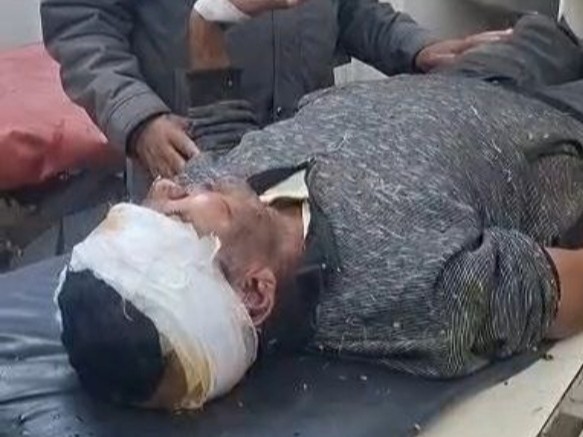 पाली के बांगड़ हॉस्पिटल में घायल युवक काे उपचार के लिए लाया गया। - Dainik Bhaskar