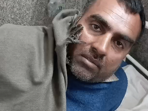 हादसे में घायल इंद्र सिंह का हॉस्पिटल में इलाज चल रहा है।