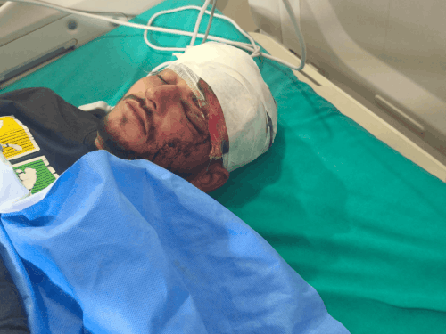 सोनीपत में 2 स्टूडेंट पर कुल्हाड़ी और डंडों से हमला:  गाली-गलौच के बाद जानलेवा हमला; पुरानी कहासुनी के चलते वार, हॉस्पिटल में एडमिट – Sonipat News