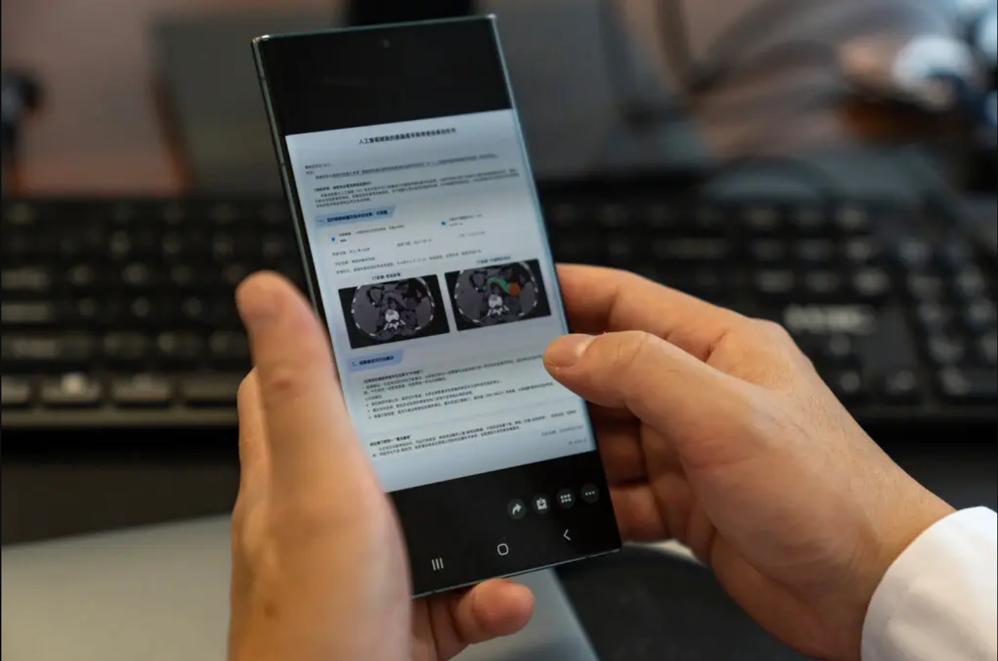 कैंसर की जांच करने वाले इस AI टूल को चीनी टेक कंपनी अलीबाबा से जुड़े रिसर्च संस्थान डामो अकादमी के वैज्ञानिकों ने बनाया है।