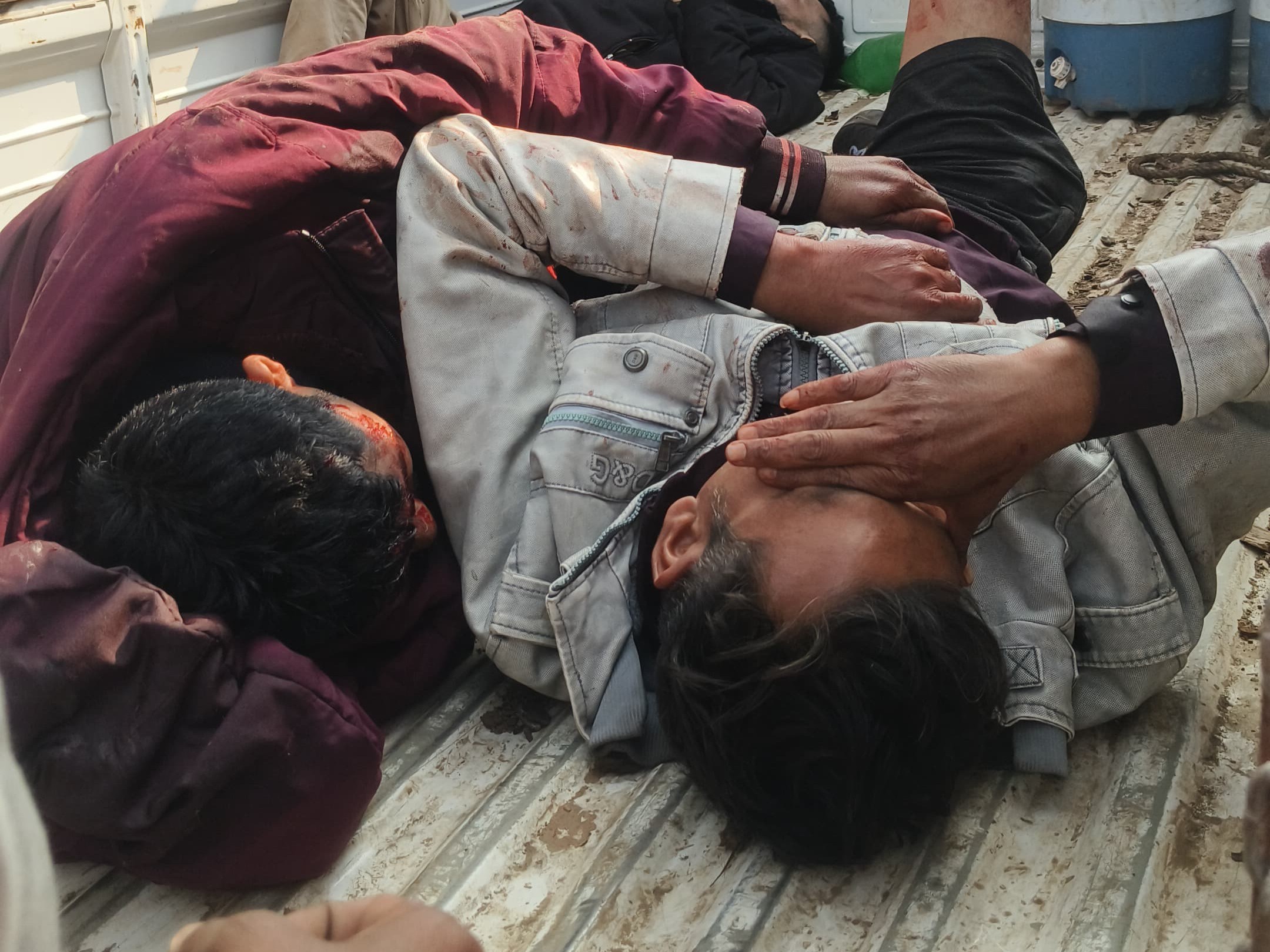 घायलों को अस्पताल ले जाया गया।