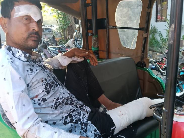 मारपीट से युवक अखिलेश का पैर फ्रैक्चर हो गया।