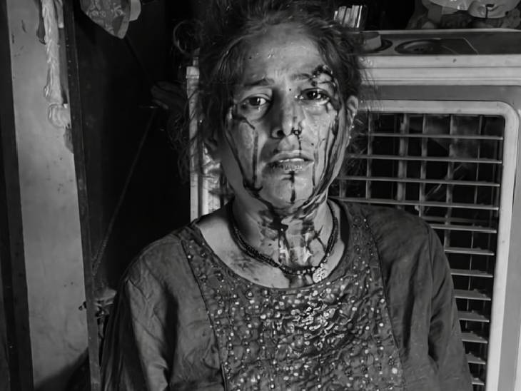 बदमाशों ने महिला सुमन के सिर पर वार किया, जिससे वह लहूलुहान हो गई।