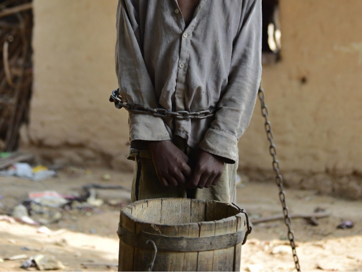 बच्चे को 2-3 महीने से बेड़ियों से बांधा जा रहा था। जिसके चलते उसके पैरों में घाव बन गए।- AI इमेज