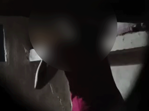 कोरबा में पिता ने बेटी के बॉयफ्रेंड को घर बुलाकर लात-घूंसों से पीट दिया। बेटी ने की सुसाइड की कोशिश। - Dainik Bhaskar