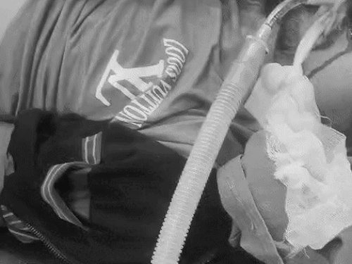 अस्पताल में भर्ती घायल अजरू खान।