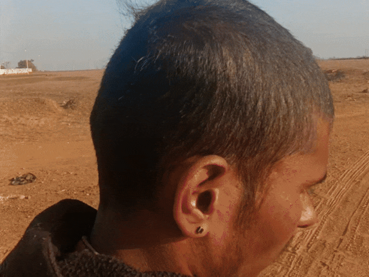 आरोपी ने मारपीट भी की थी। रोहित ने चोट के निशान दिखाए।