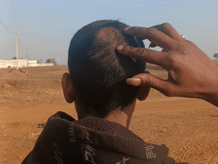 चोटी उखाड़ने वाले स्थान को बताता हुआ पीड़ित रोहित।