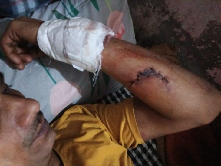 चंडीगढ़ में वाहनों के शीशे तोड़ने के बाद मारपीट:  धनास मिल्क कालोनी में घटी घटना, दो घायल, उपचार के लिए GMSH करवाया दाखिल – Chandigarh News