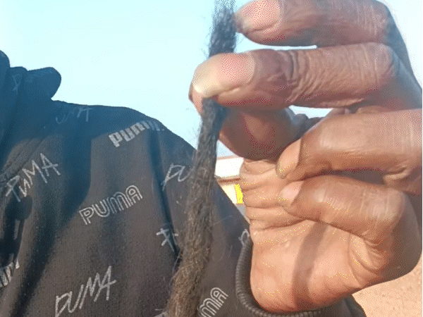 पीड़ित रोहित यादव ने अपनी उखाड़ी गई चोटी दिखाई।