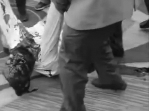 सरपंच के सिर में गोली लगने के बाद वह लहूलुहान होकर जमीन पर गिर पड़े। उन्हें लोगों ने उठाकर अस्पताल पहुंचाया।