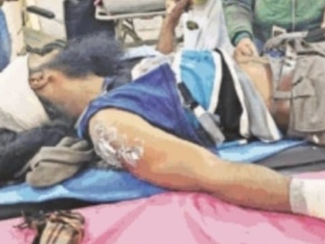 बिजली कर्मी सिविल अस्पताल भर्ती। - Dainik Bhaskar