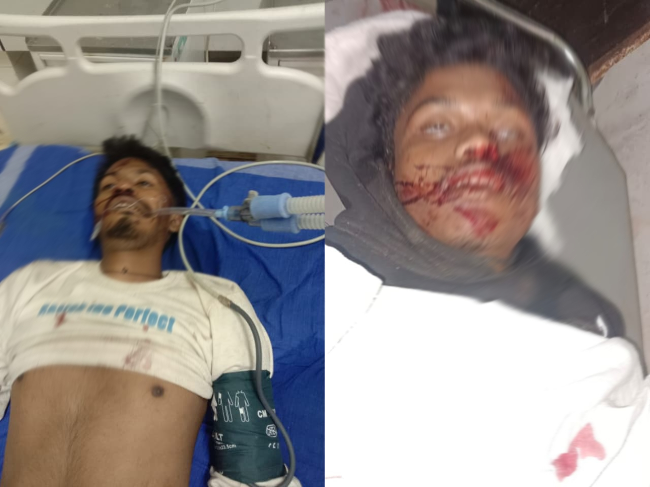 हादसे में घायल हो युवकों की हो गई मौत