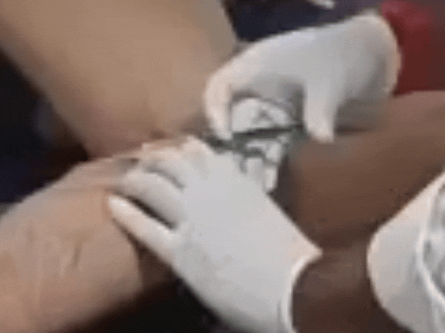 घायल होने वालों में 3 स्थानीय निवासी और 5 श्रद्धालु है।