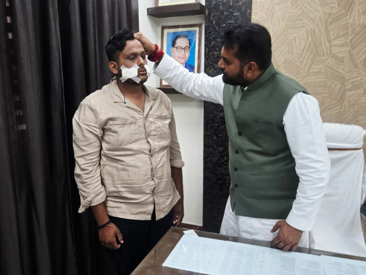 चाइनीज मांझे से कट लगने से छात्र को 34 टांके लगाने पड़े।