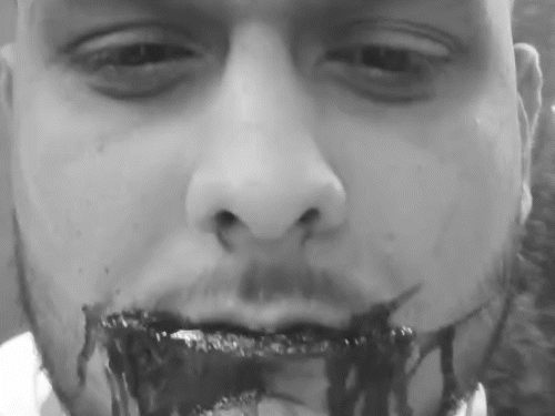 रायपुर में चाइनीज मांझे से एक छात्र के गाल कट गए। - Dainik Bhaskar