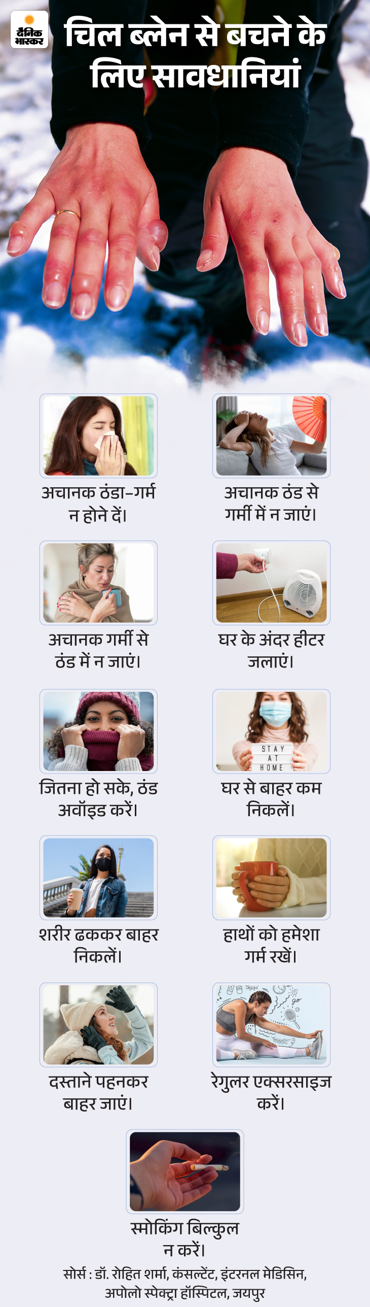 Winter Finger Inflammation Reason; Chilblains Symptoms & Risk Factors 17 zkk in winter the fingers become swollen 18 01 202 1768479007 -