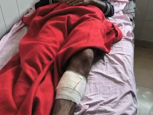 घायल आरोपी को प्राथमिक इलाज के लिए हनुमानगढ़ जिला अस्पताल में भर्ती करवाया।
