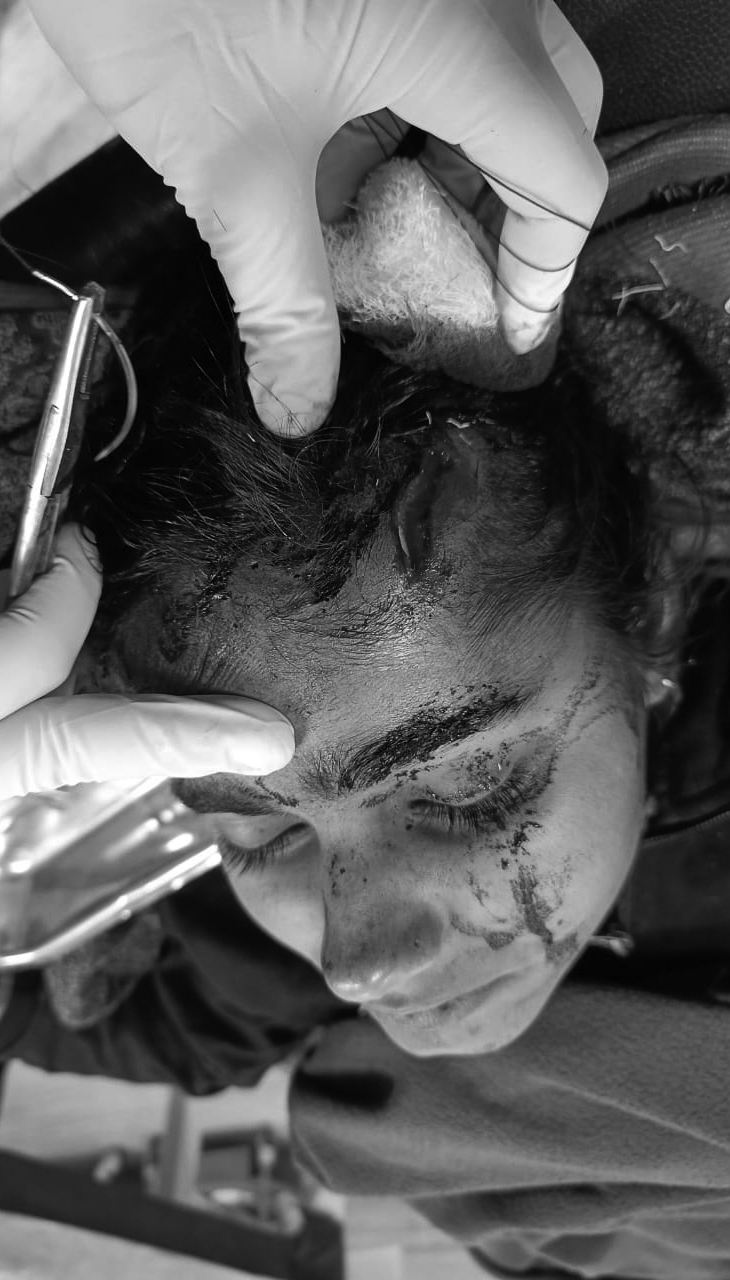 पटरी के किनारे गिरने के कारण लड़की के सिर में गहरी चोट लगी थी।