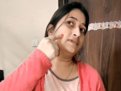 मॉडल प्रज्ञा शुक्ला का चेहरा ब्यूटी पार्लर में केमिकल से जल गया था। - Dainik Bhaskar