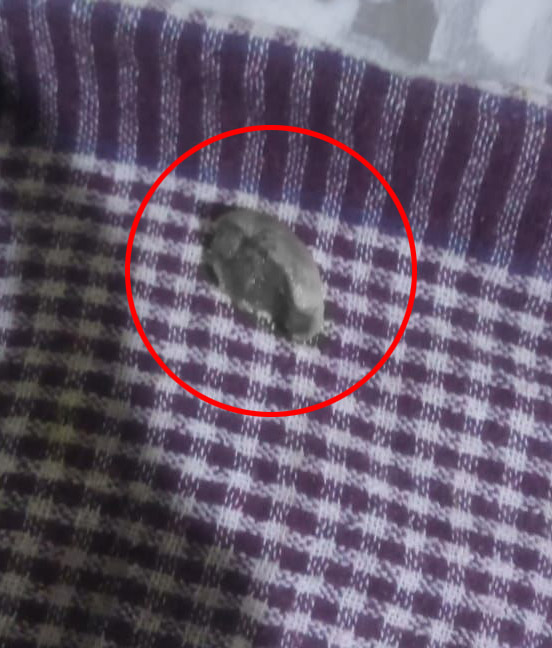 यह विपिन जीभ के टुकड़े को परिवार के लोग अस्पताल ले गए हैं। उसे डॉक्टरों को दिया गया है।