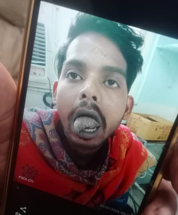 विपिन की जीभ कट गई है। उसके साथ यह वारदात उसकी पत्नी ने ईशा ने की।