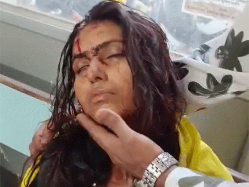 पुरानी बस्ती थाने लहूलुहान हालत में पहुंची युवती।