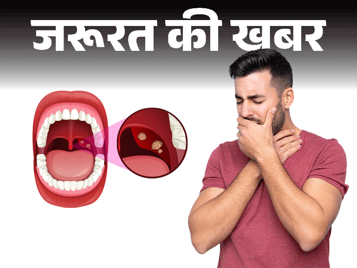 গুরুত্বপূর্ণ খবর- টনসিলাইটিসের কারণে গলা ব্যথা হতে পারে: ডাক্তারের কাছ থেকে জেনে নিন এটি কী, কেন হয়, লক্ষণ ও প্রয়োজনীয় সতর্কতা।