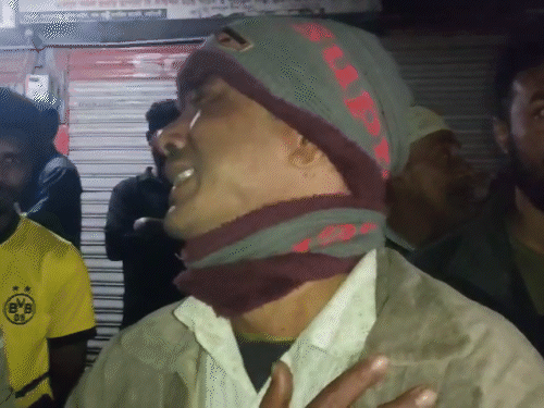 चंचल के जले हुए शव को देखकर उनके परिवार के एक सदस्य बिलख-बिलखकर रो पड़े।