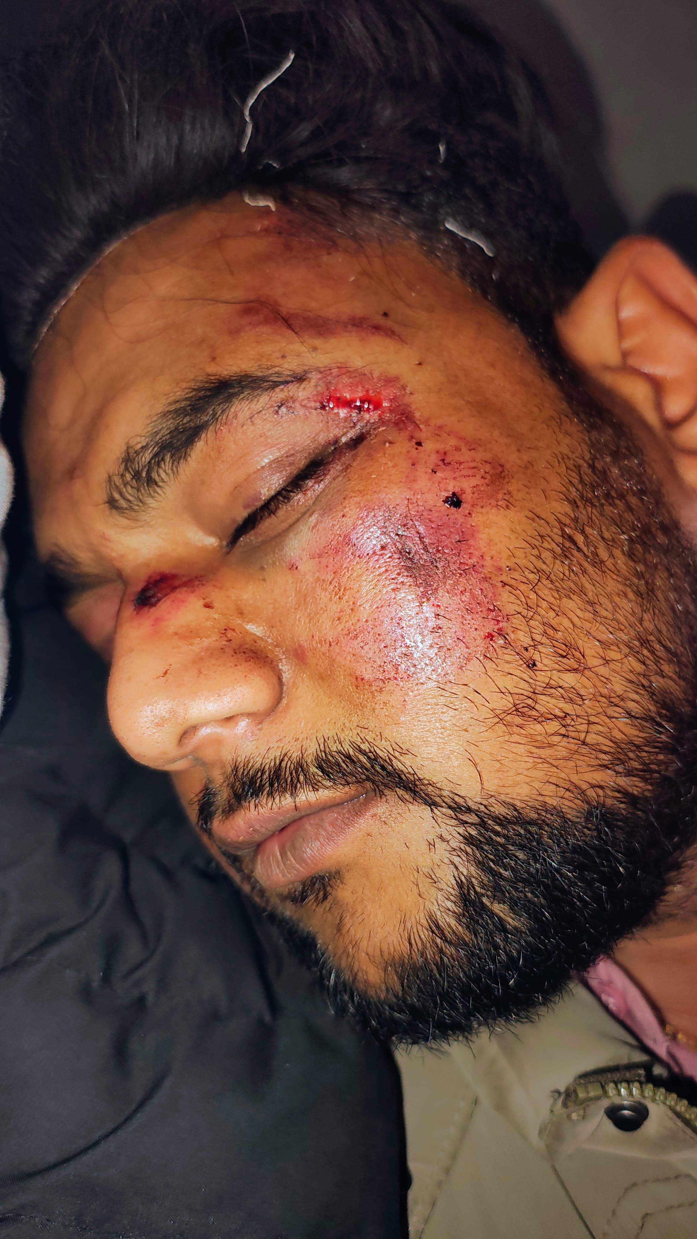 आरोपियों ने पवन के दोस्त प्रशांत को भी जमकर पीटा।