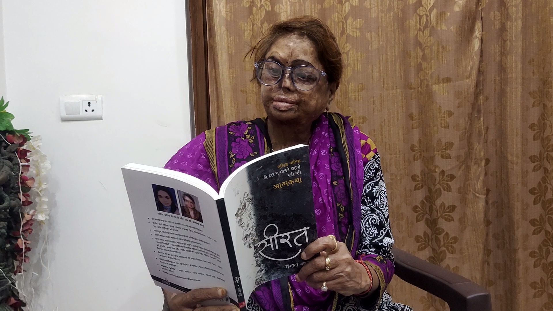 Varanasi Acid Attack Survivor Mangla Kapoor Awarded Padma Shri